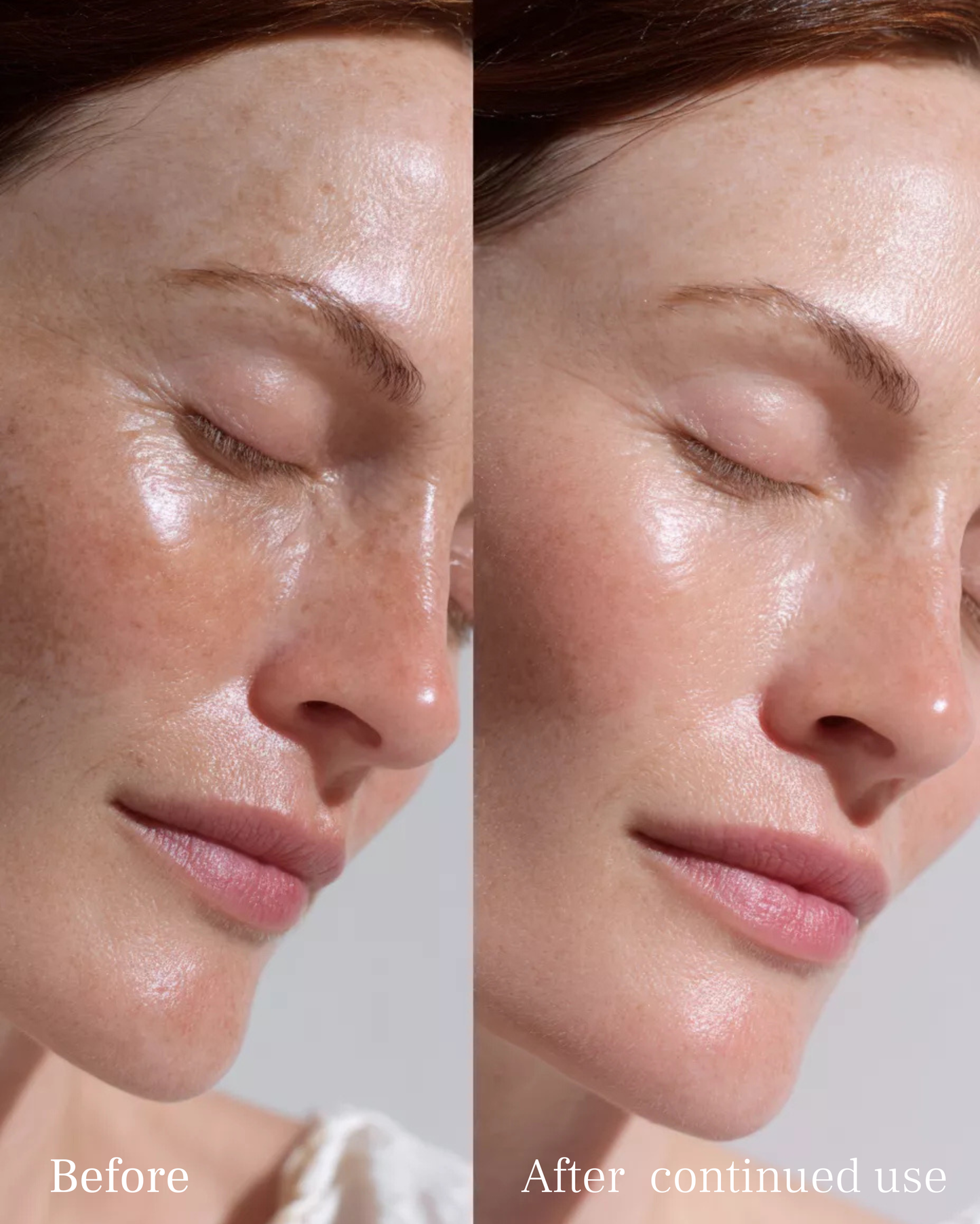 Kojic Acid (1%) Dark Spot Correcting Serum